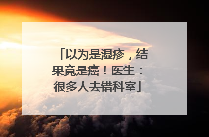 以为是湿疹，结果竟是癌！医生：很多人去错科室